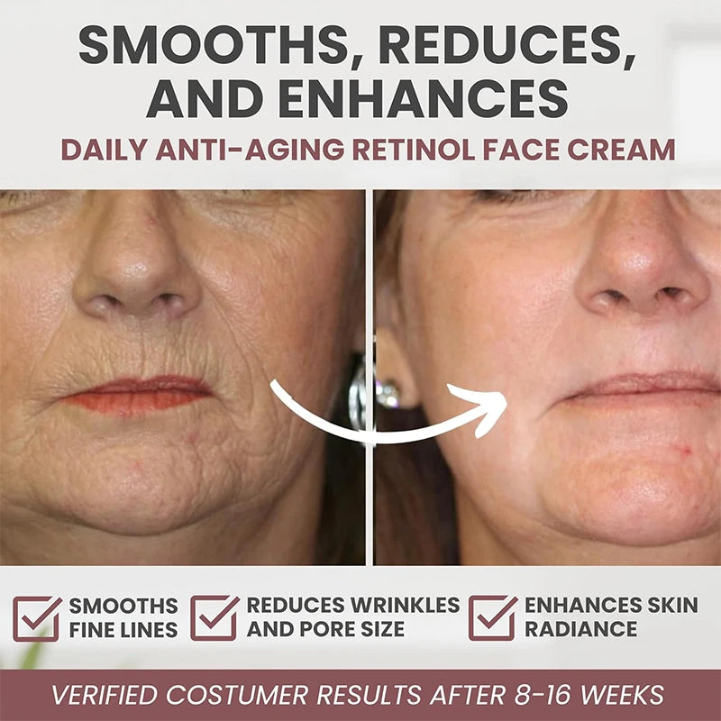 Instant Retinol Cream – Anti-Aging Wrinkle Remover