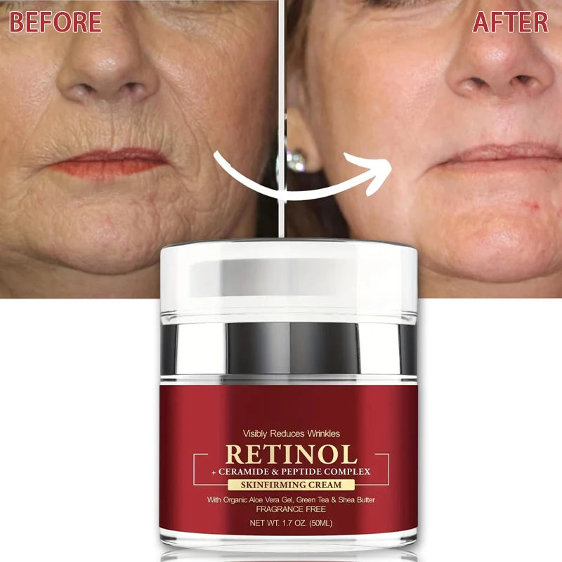 Instant Retinol Cream – Anti-Aging Wrinkle Remover